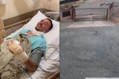 Motociclista &eacute; internado ap&oacute;s ser arrastado pelo pesco&ccedil;o por fios soltos em Joinville