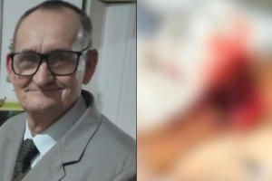 Idoso &eacute; levado para o hospital ap&oacute;s ter peda&ccedil;o de bra&ccedil;o arrancado por pitbull, em Joinville