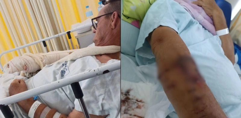 Idoso deixa hospital ap&oacute;s ter bra&ccedil;o dilacerado por pitbull, em Joinville