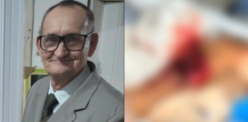 Idoso &eacute; levado para o hospital ap&oacute;s ter peda&ccedil;o de bra&ccedil;o arrancado por pitbull, em Joinville