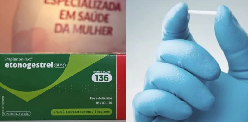 Joinville recebe capacita&ccedil;&atilde;o para ampliar oferta de implante contraceptivo no SUS