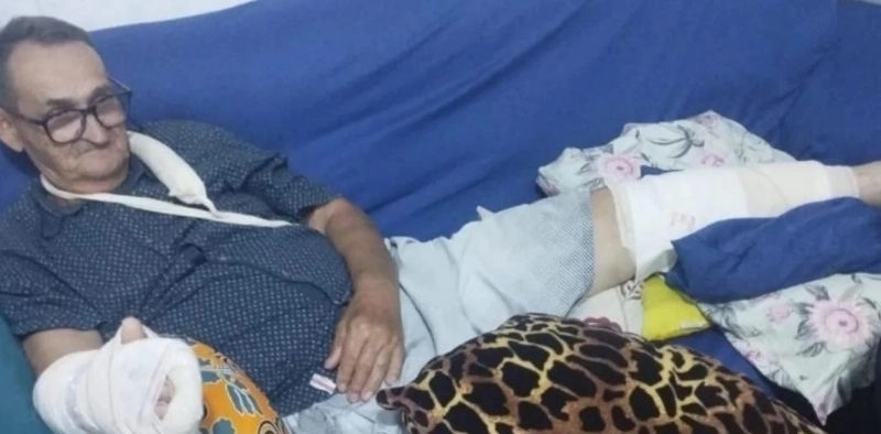 Fam&iacute;lia de idoso atacado por pitbull organiza vaquinha para custear tratamento, em Joinville